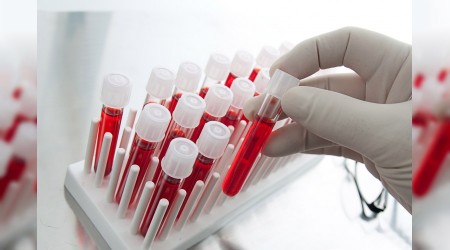 'Gençleşmek' için kan ticareti