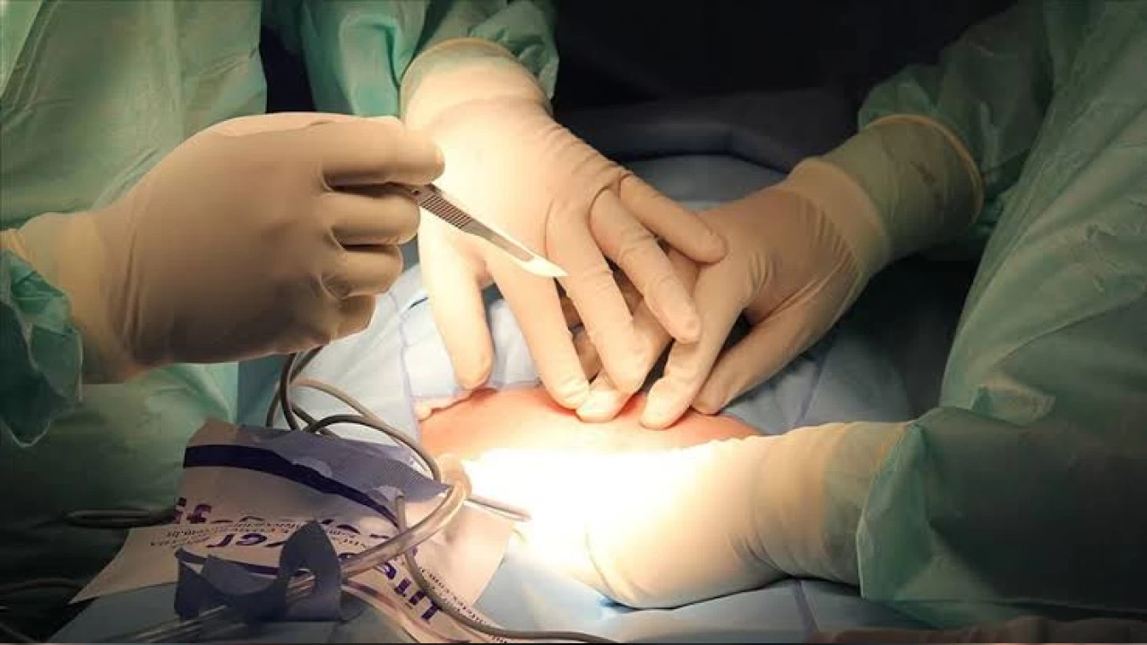 ABD'de, ilk defa bir hastaya geneti�i de�i�tirilmi� domuz b�bre�i nakledildi