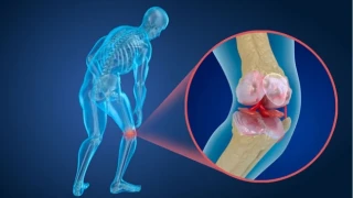 Menisk�s Y�rt��� Sadece Sporcular�n De�il, Herkesin Sorunu