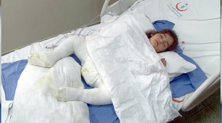 Oyun oynayan �ocuk yanan tand�ra d��t�