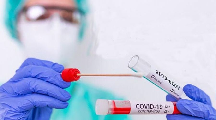 Covid-19 a��lar�n�n takibi 'A��la' uygulamas�nda
