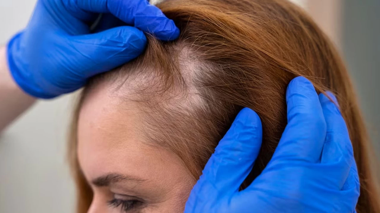 Dökülen saçlar vücudun bir alarmı olabilir