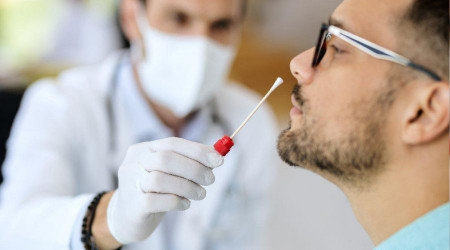 Eskişehir'de negatif PCR testi zorunluluğu kalktı