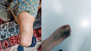 Ayak topuundan 37 santim tel kt