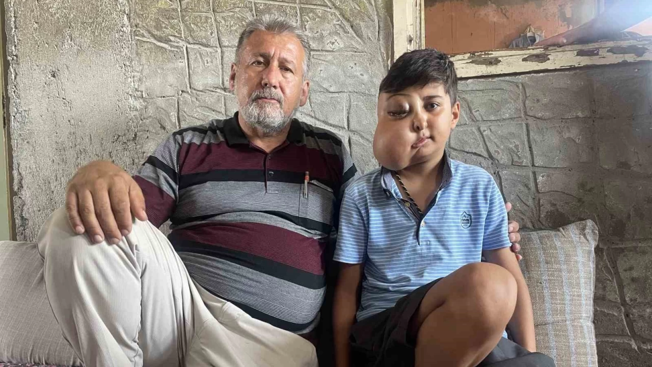 �ki farkl� y�z� var gibi g�r�nen �ocu�un tek iste�i...