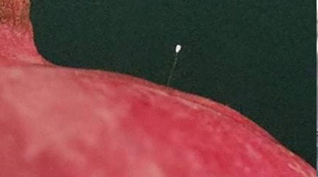 Nar üzerinde 'Udumbara' çiçeği görüldü
