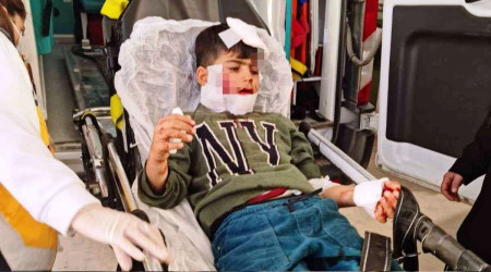 Nusaybin'de köpekler, çocuğu ağır yaraladı