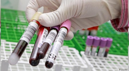 Yeni kan testi yüzde 75 başarı sağladı