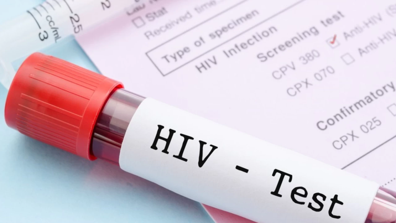 Erkek s�nneti, HIV enfeksiyonuna kar�� koruyor