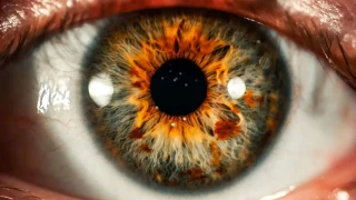 Miyopi Art�yor �ocuklarda Erken �nlem Hayati �nem Ta��yor