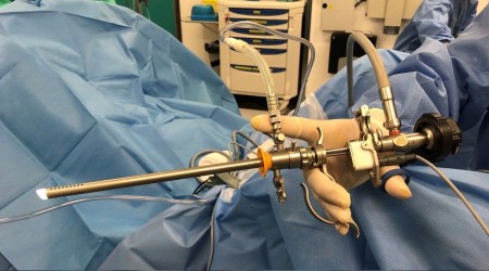 Prostat büyümesine BipoLEP’li çözüm