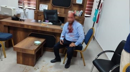 Şanlıurfa'da okul müdürüne alçak saldırı