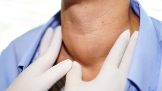 Tiroid Kanserinde Erken Tanı Hayat Kurtarıyor