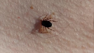 Dou Karadeniz'de kenede bu yaz korkulan olmad