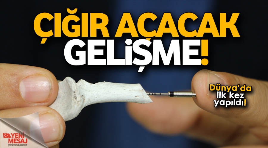 İmplant’ta çığır açacak gelişme!