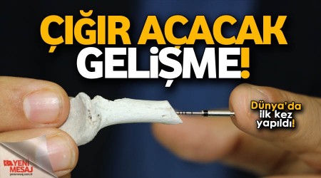 İmplant’ta çığır açacak gelişme!