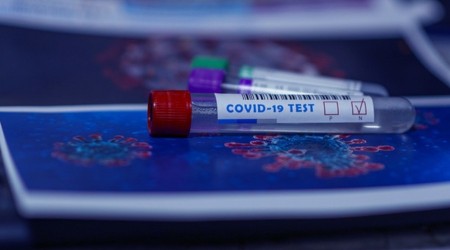 Latin Amerika'da vakalar hzla artyor