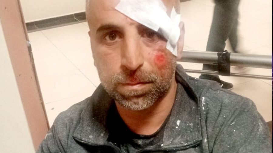 Sokak k�pekleri iki ki�iyi yaralad�