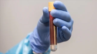 50 yaş üstü her erkek bu testi yaptırmalı!