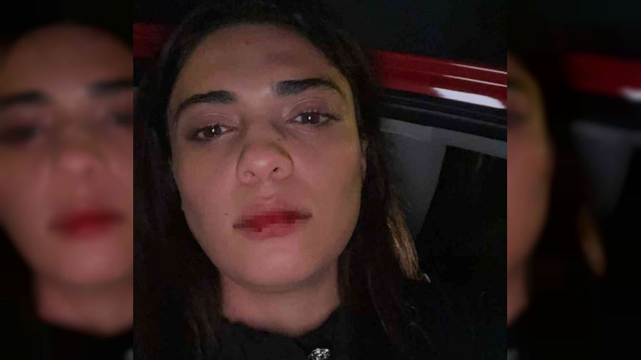 Azerbaycanlı şarkıcı, İstanbul'da taksicinin saldırısına uğradı