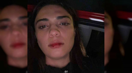 Azerbaycanlı şarkıcı, İstanbul'da taksicinin saldırısına uğradı