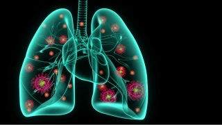 Bu besinler akciğerleri pırıl pırıl yapıyor!