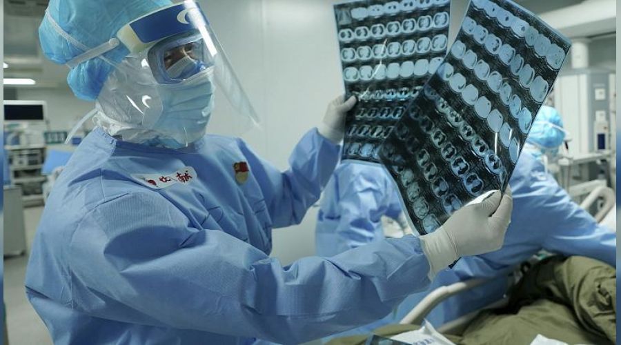 Covid-19 semptomları 6 ay devam edebiliyor
