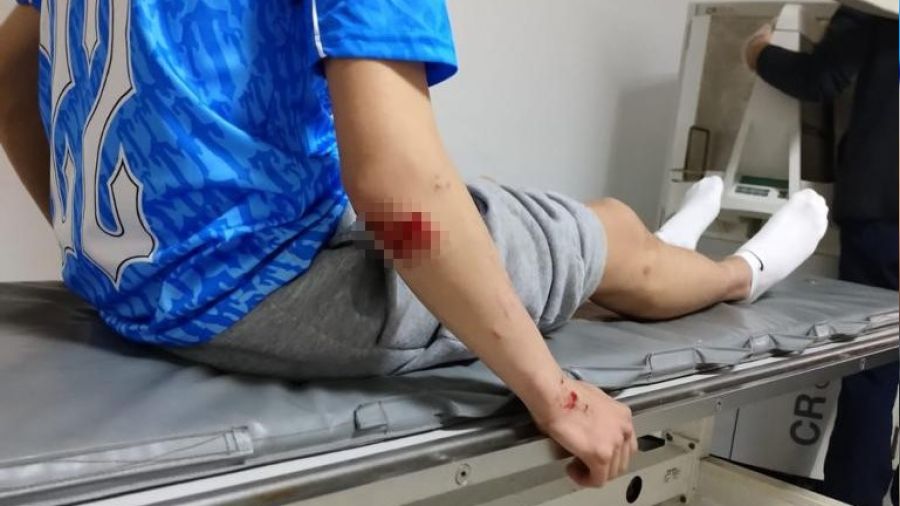 Okul ��k��� k�peklerin sald�rd��� �ocuk hastanelik oldu