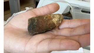 Şiddetli karın ağrısına dikkat!