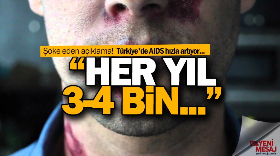 T�rkiye'de AIDS riski art�yor