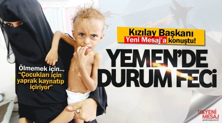 Yemen'de durum feci