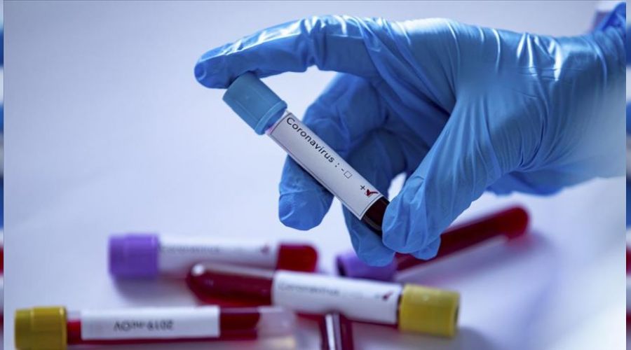 17 bin 912 kişinin testi pozitif çıktı, 245 kişi hayatını kaybetti