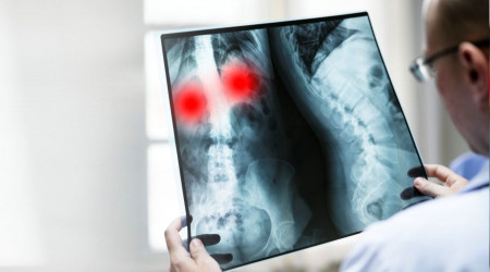 40 yaşından sonra ihmal edilmemesi gereken 10 test