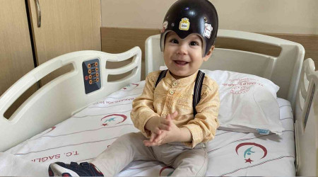 Bebeklerde kafatası şekil bozukluğuna dikkat!