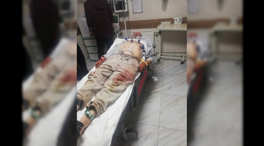 Besicilerin mera kavgas� kanl� bitti