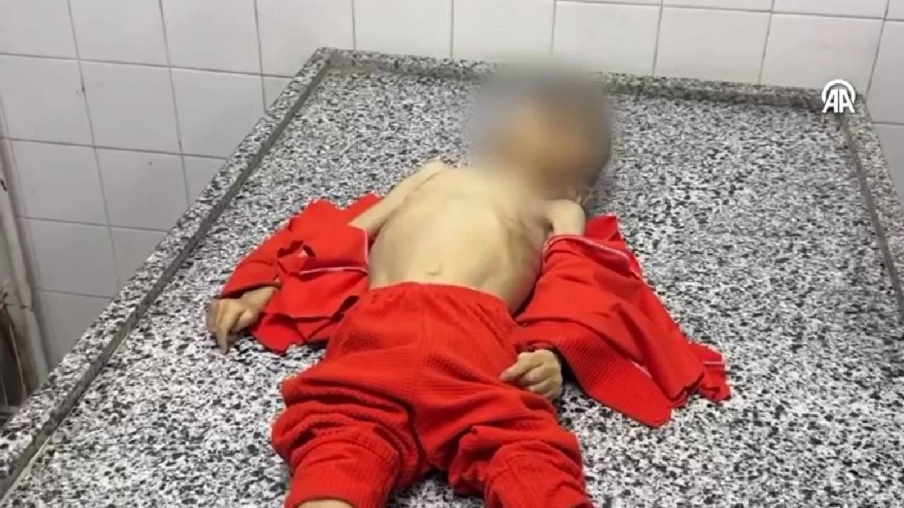 Gazze'de 4 yaşındaki çocuk açlıktan öldü
