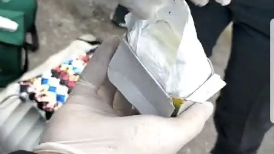 3 aylık bebeğin karnında uyuşturucu çıktı