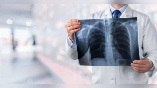 Akciğer kanseri görülme yaşı gittikçe düşüyor