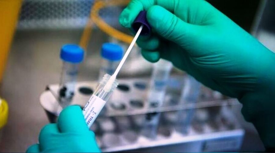 Aşı olmayanlara PCR testi ücretli olacak