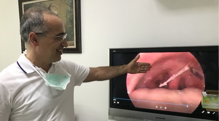 Balık kılçığı batması şikayetleri arttı