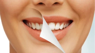 Bu Doğal Besinler Dişlerinizi Bembeyaz Yapıyor