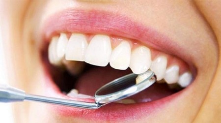 Dijital gülümseme tasarımını hiç duydunuz mu?