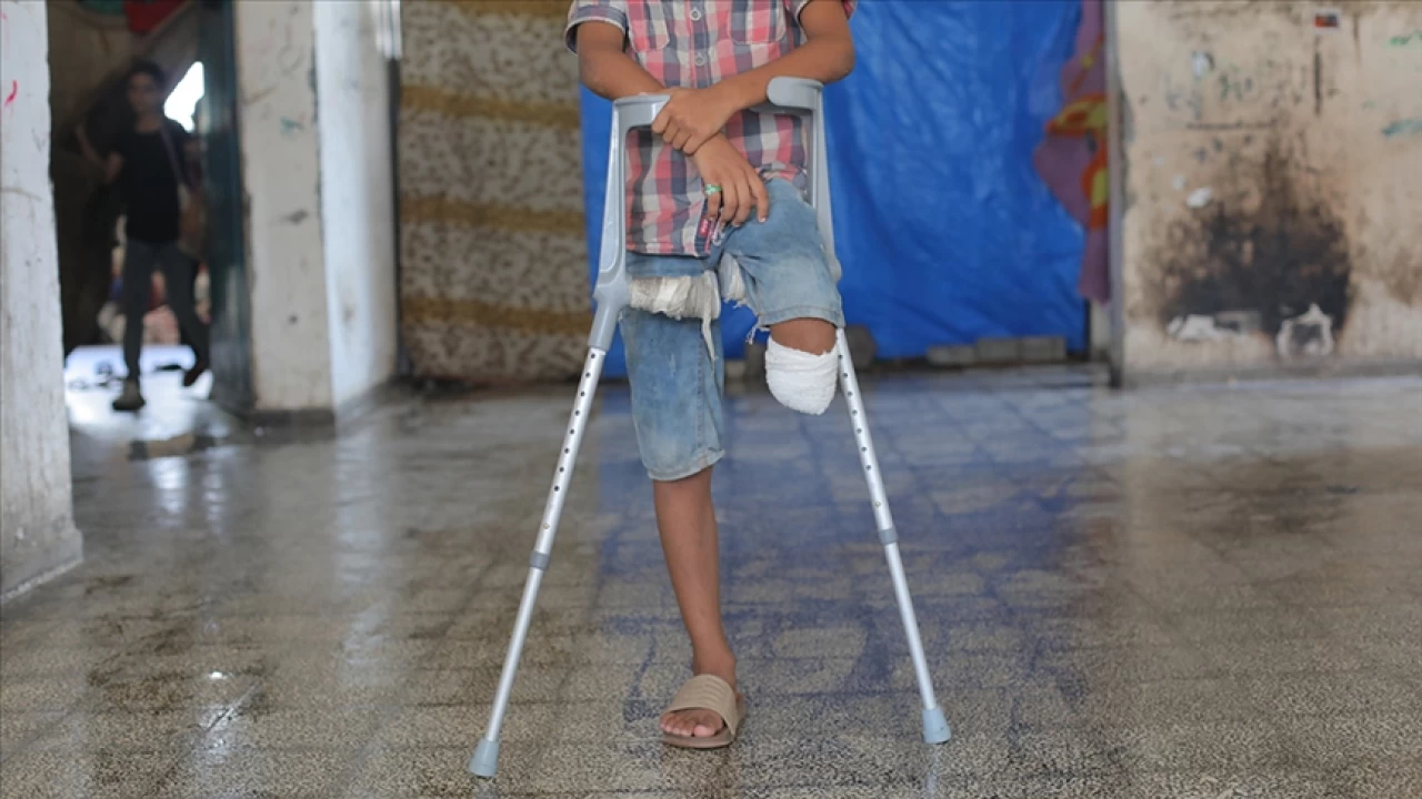 Gazze'de binlerce çocuk ayağını kaybetti