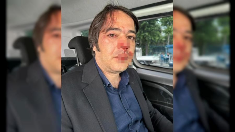 İBB İmar Müdürü Ramazan Gülten darbedildi