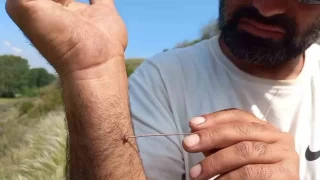 "Kenenin vcutta kalma sresi hastaln bulama riskini ykseltiyor"