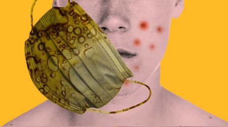Maskne ile nasıl başa çıkılır?