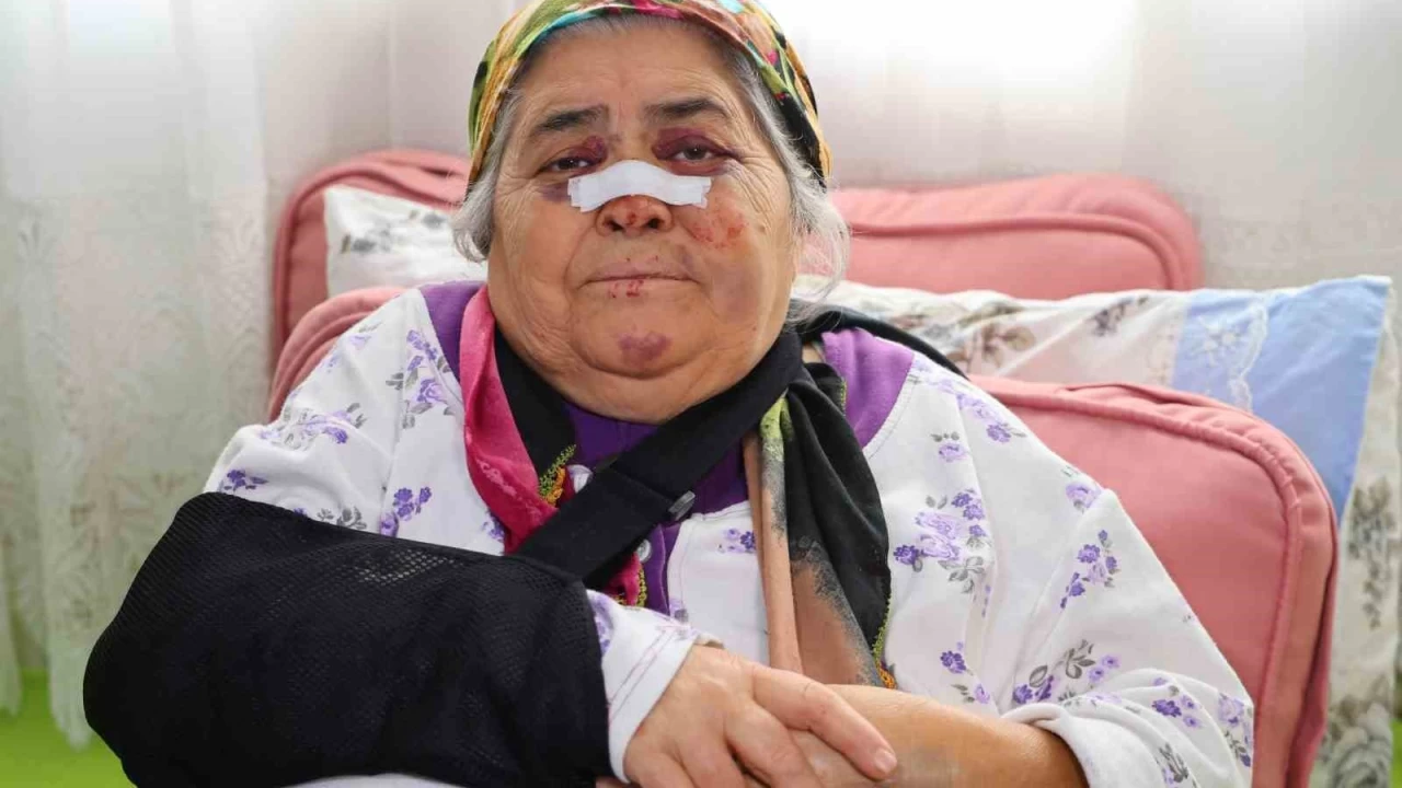 Otomobilin �arpt��� kad�n: 'G�z�m�n i�ine bak�p ka�t�'