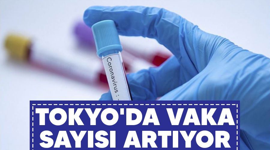 Tokyo'da vaka says artyor