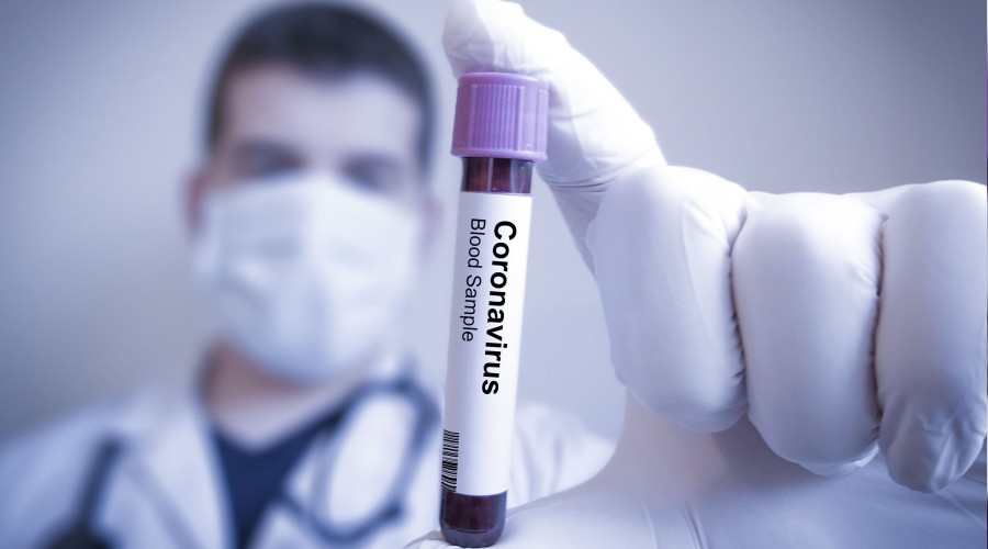  Vakalardaki art�� OHAL ilan ettirdi 