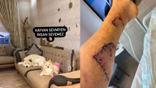Çin Aslanı sahibinin bacağını parçaladı